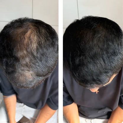 AuraHair™ - Polvere Capelli Istantanea